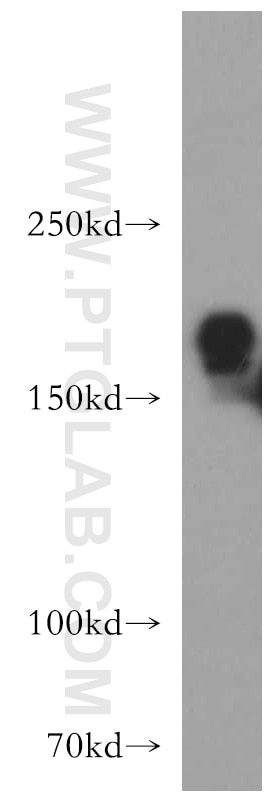 Western Blot (WB) analysis of HeLa cells using GOLGA3 Polyclonal antibody (21193-1-AP)