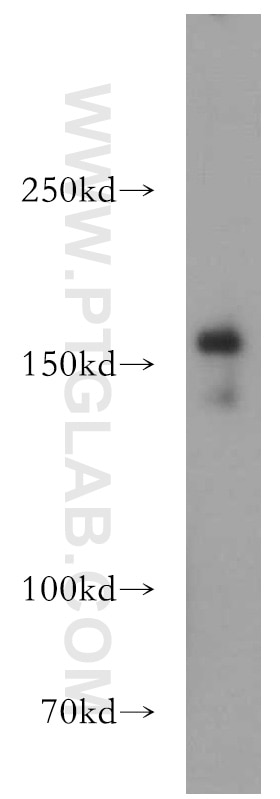 Western Blot (WB) analysis of human testis tissue using GOLGA3 Polyclonal antibody (21193-1-AP)