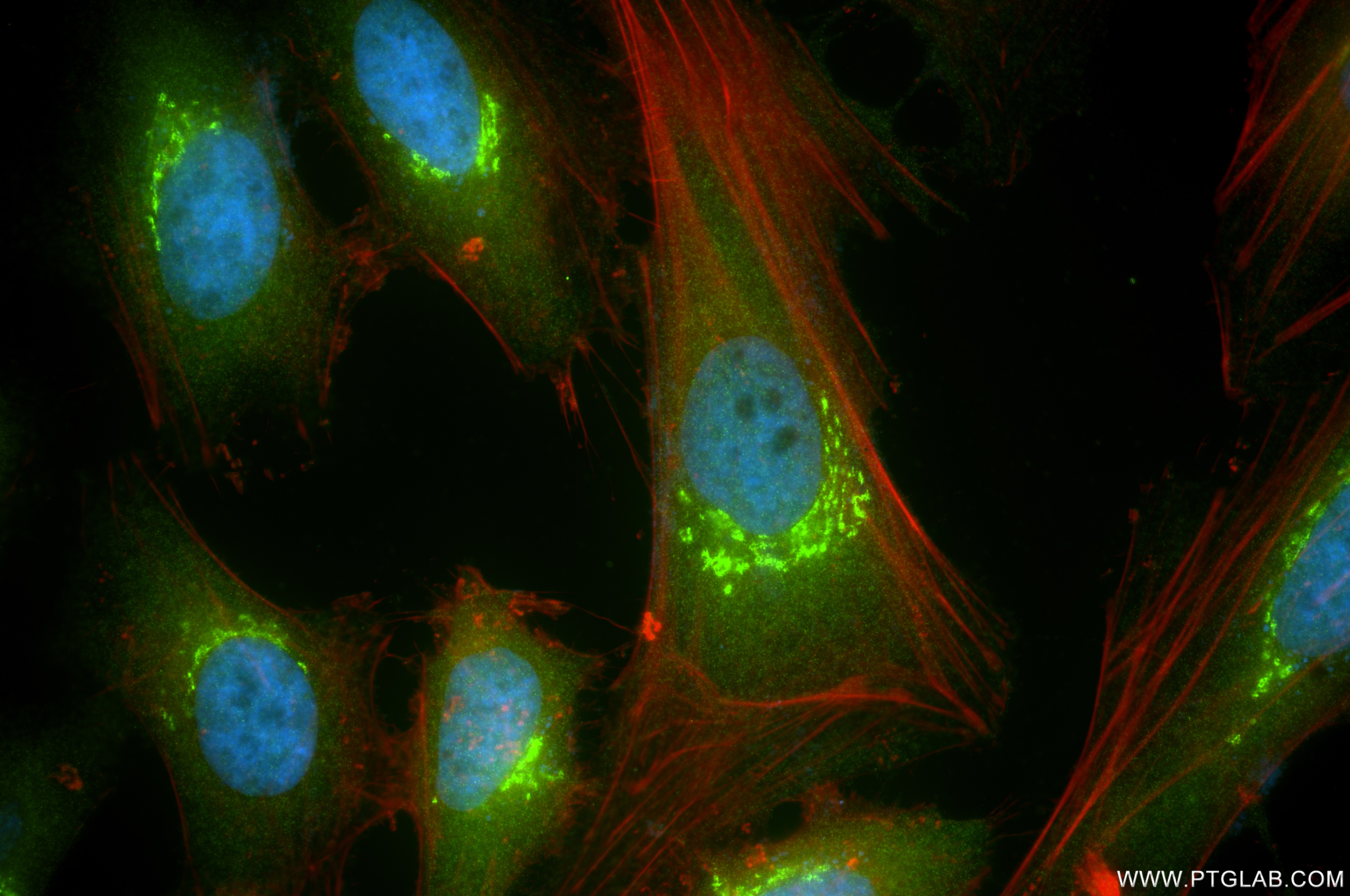 Immunofluorescence (IF) / fluorescent staining of HeLa cells using GOLGA3 Recombinant antibody (84955-4-RR)