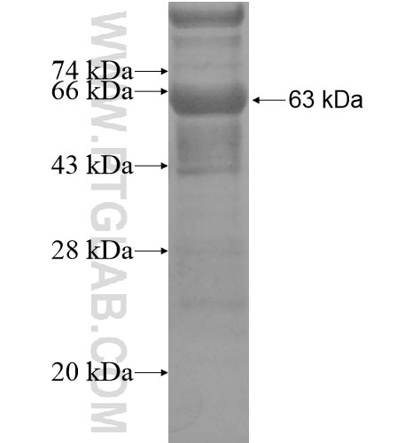 GOLGA3 fusion protein Ag15531 SDS-PAGE