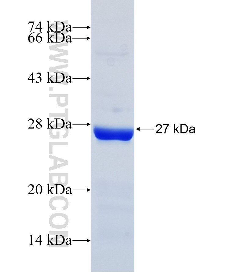 GOLGA5 fusion protein Ag36799 SDS-PAGE GOLGA5 fusion protein Ag36799 SDS-PAGE