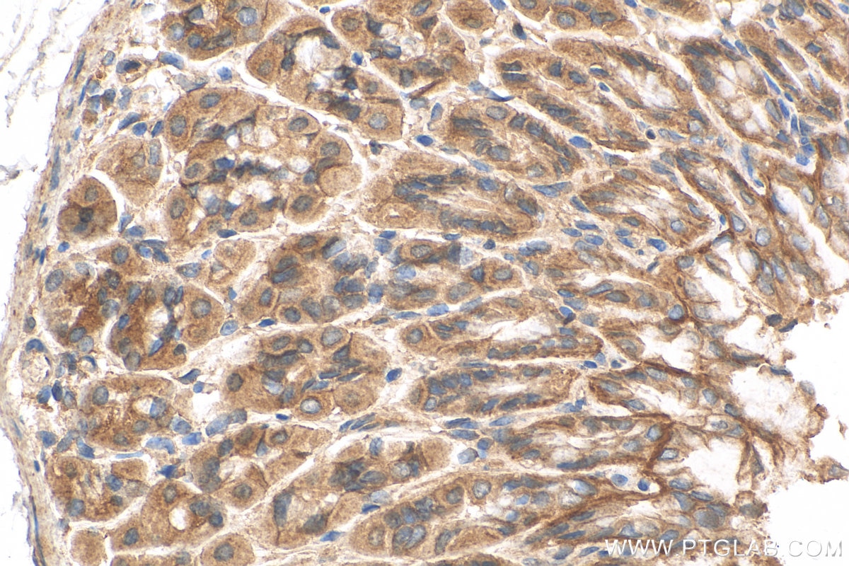 Immunohistochemistry (IHC) staining of mouse stomach tissue using GOLGA7 Polyclonal antibody (14723-1-AP)