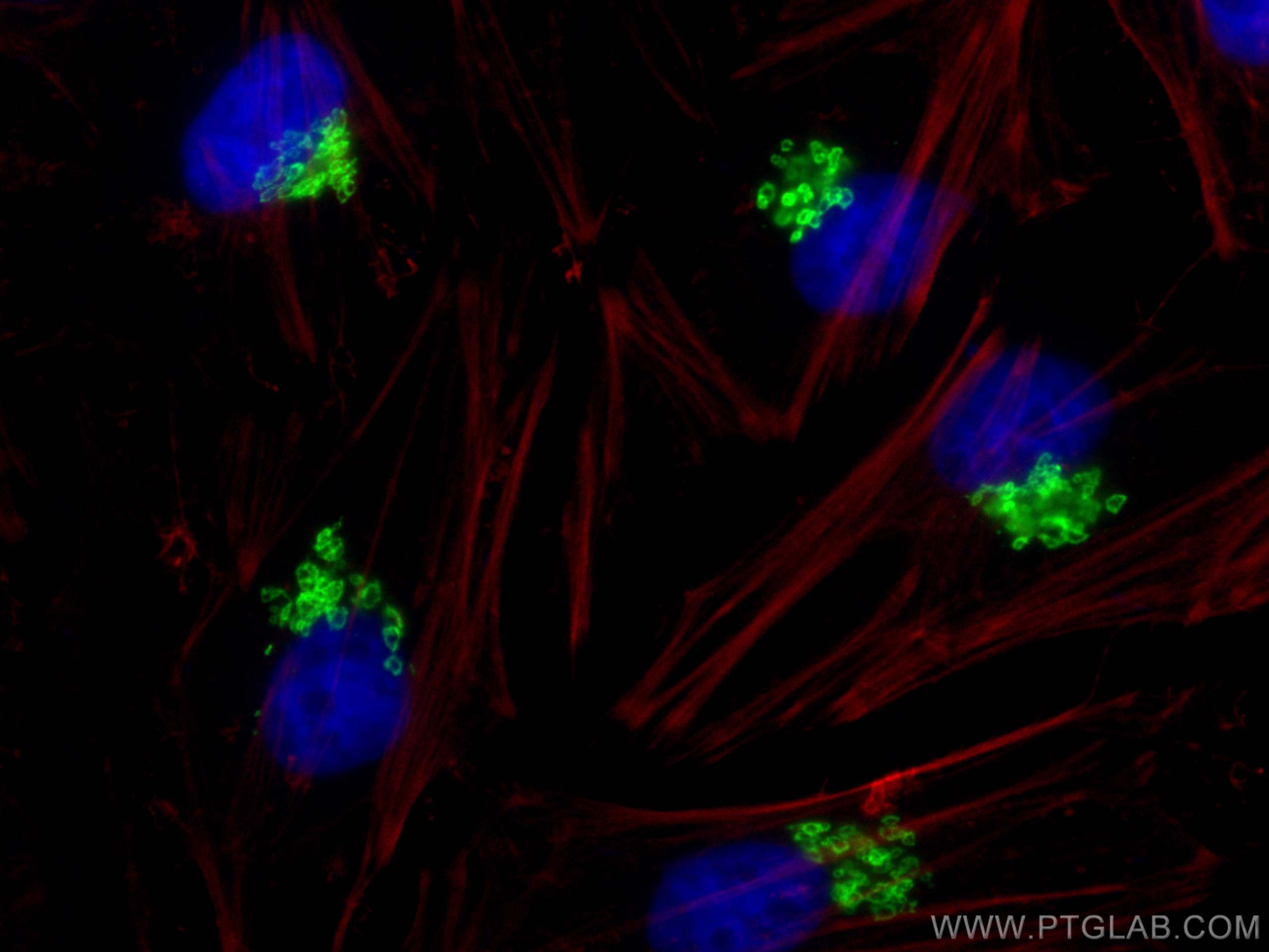 Immunofluorescence (IF) / fluorescent staining of HeLa cells using GOLIM4 Polyclonal antibody (31083-1-AP)