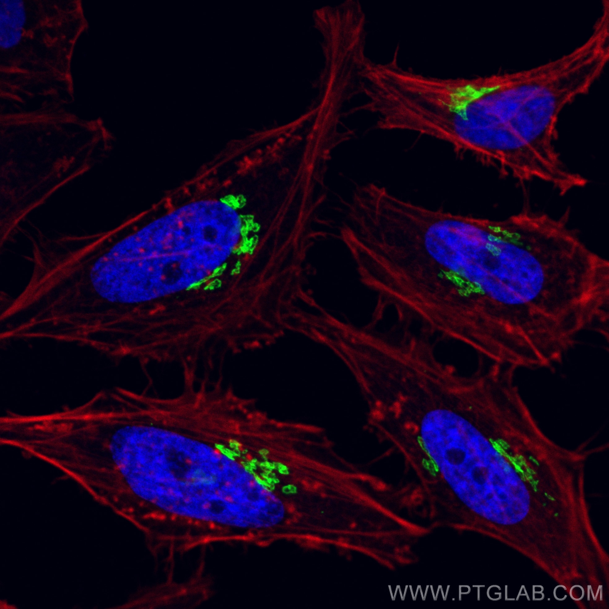 Immunofluorescence (IF) / fluorescent staining of HeLa cells using GOLIM4 Polyclonal antibody (31083-1-AP)