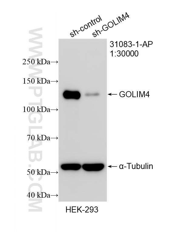 Western Blot (WB) analysis of HEK-293 cells using GOLIM4 Polyclonal antibody (31083-1-AP)