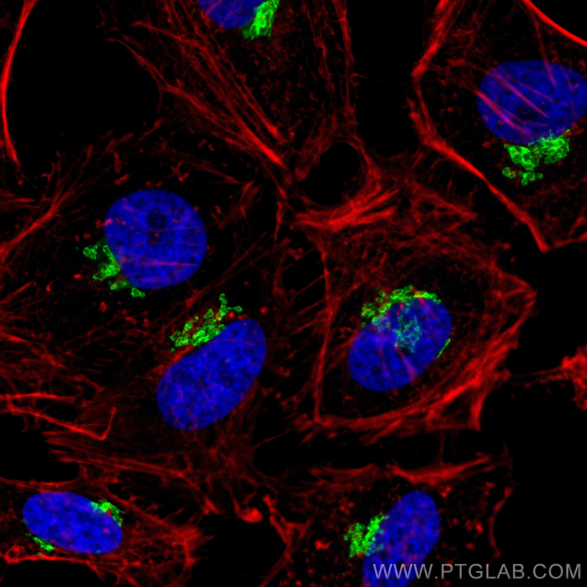Immunofluorescence (IF) / fluorescent staining of HeLa cells using GOLIM4 Recombinant antibody (84818-5-RR)