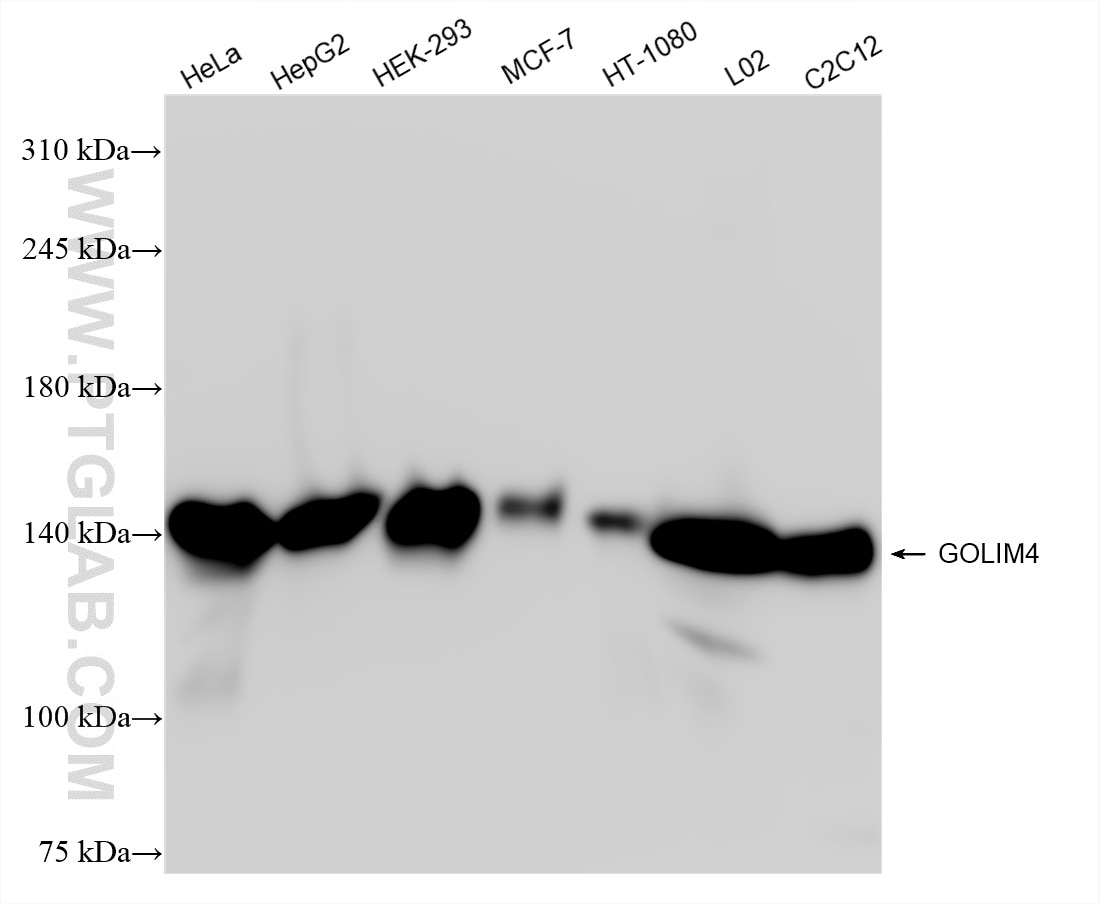 Western Blot (WB) analysis of various lysates using GOLIM4 Recombinant antibody (84818-5-RR)