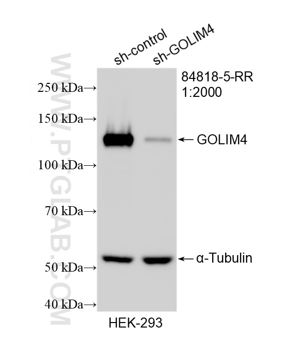 WB result of GOLIM4 antibody (84818-5-RR; 1:2000; incubated at room temperature for 1.5 hours) with sh-Control and sh-GOLIM4 transfected HEK-293 cells. Western Blot (WB) analysis of HEK-293 cells using GOLIM4 Recombinant monoclonal antibody (84818-5-RR)