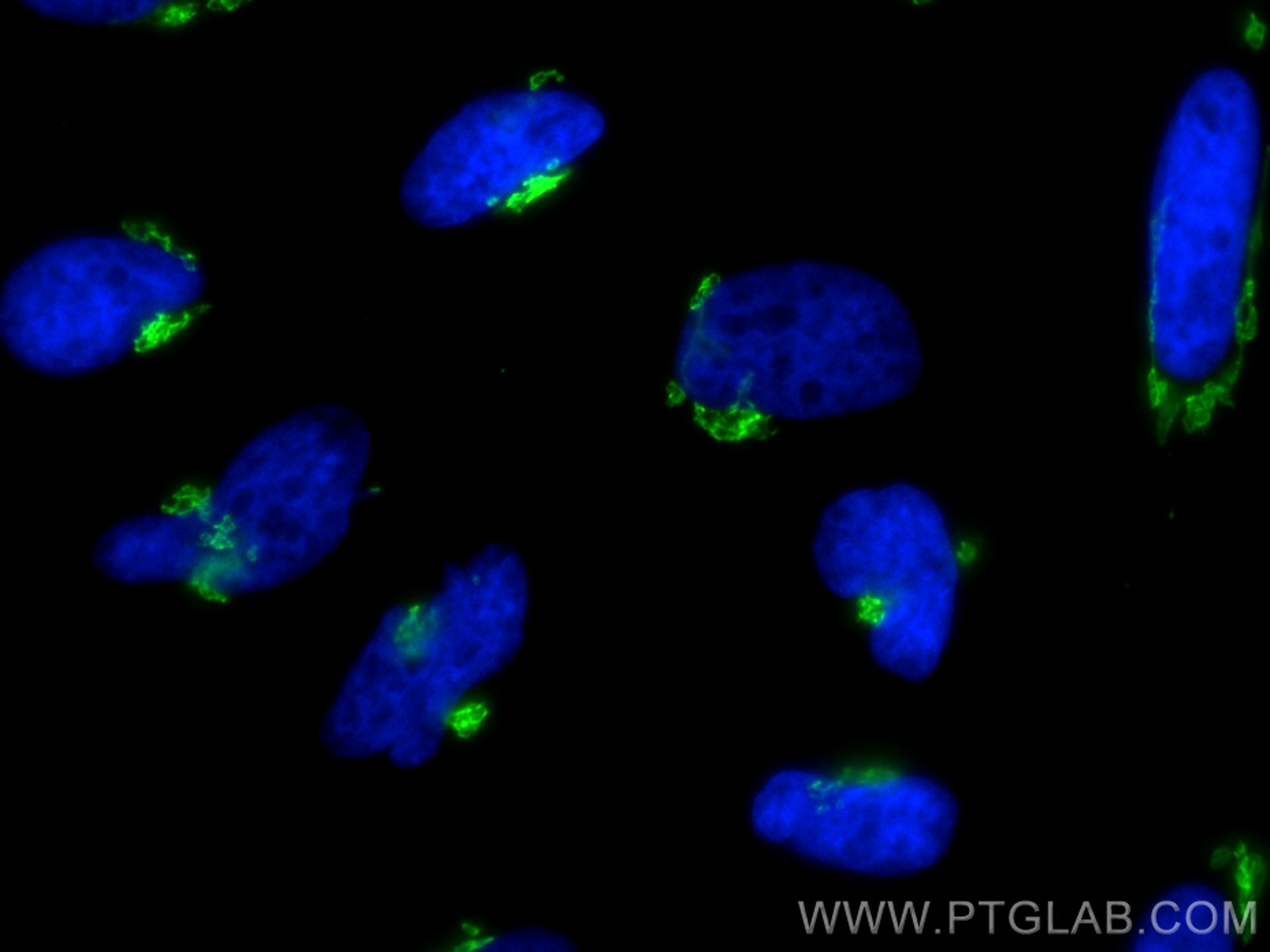Immunofluorescence (IF) / fluorescent staining of HeLa cells using CoraLite® Plus 488-conjugated GOLIM4 Recombinant a (CL488-84818-5)
