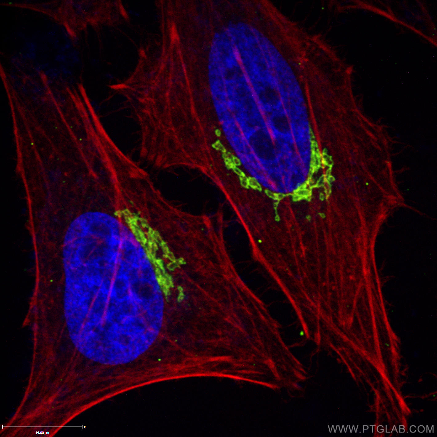 Immunofluorescence (IF) / fluorescent staining of HeLa cells using GP73/GOLPH2 Polyclonal antibody (15126-1-AP)