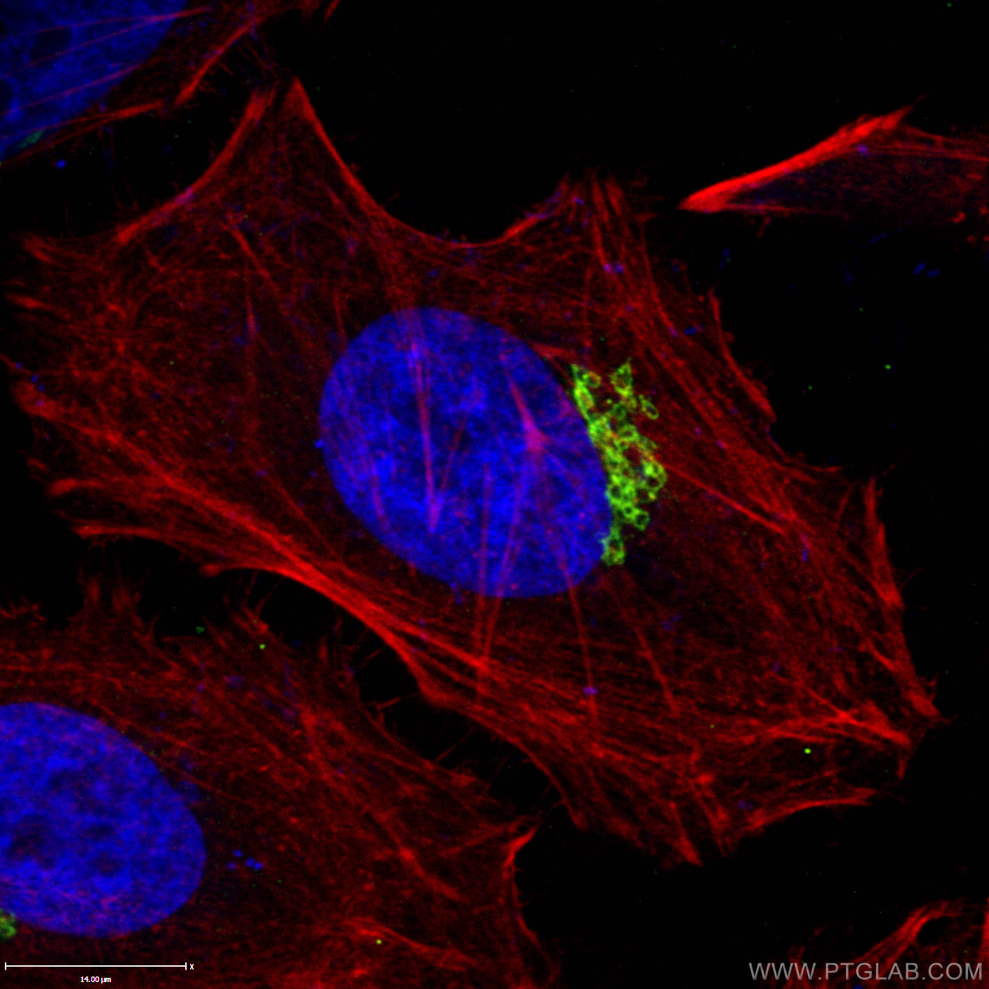 IF Staining of HeLa using 15126-1-AP