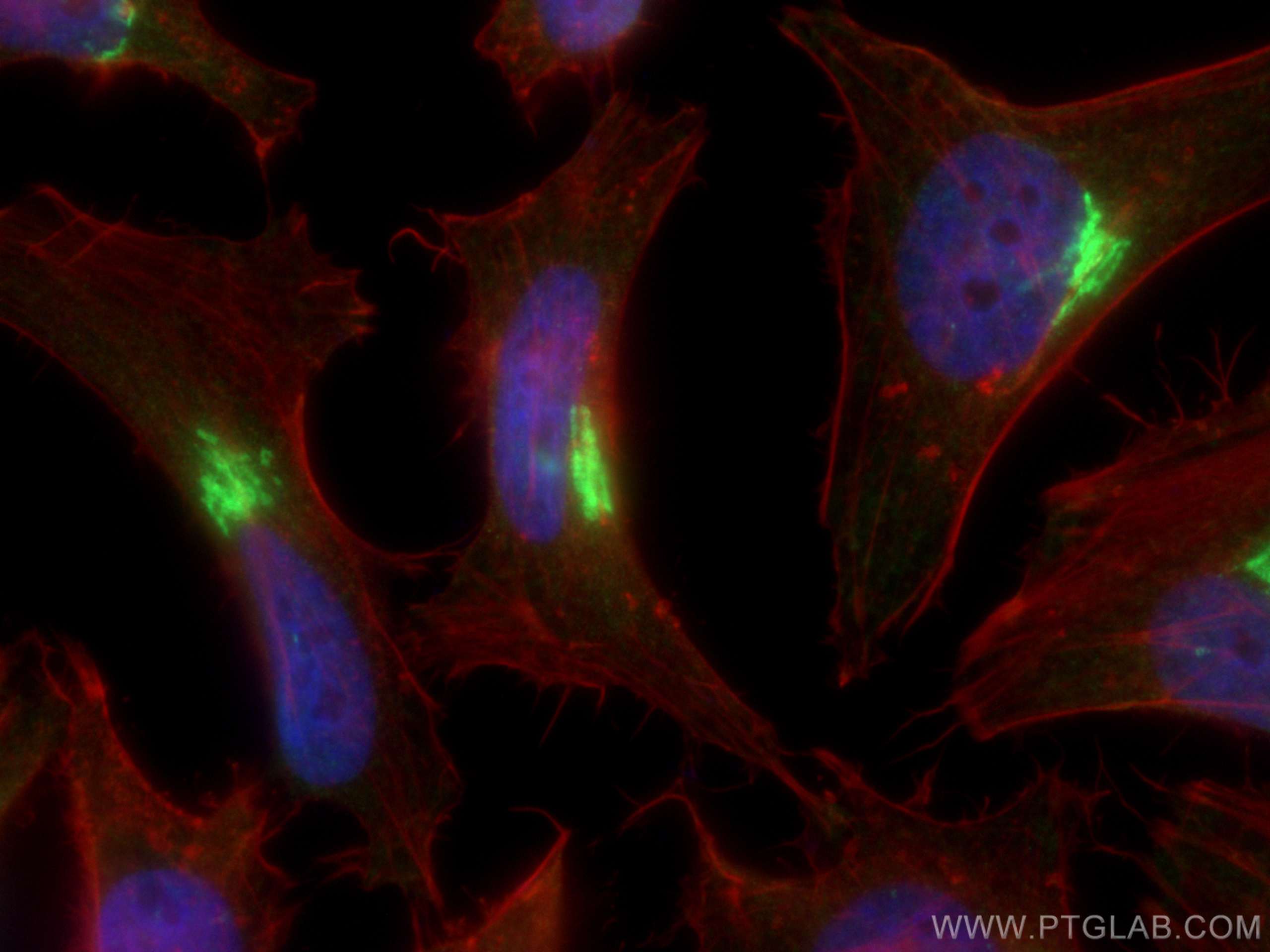 Immunofluorescence (IF) / fluorescent staining of HeLa cells using GP73/GOLPH2 Polyclonal antibody (15126-1-AP)