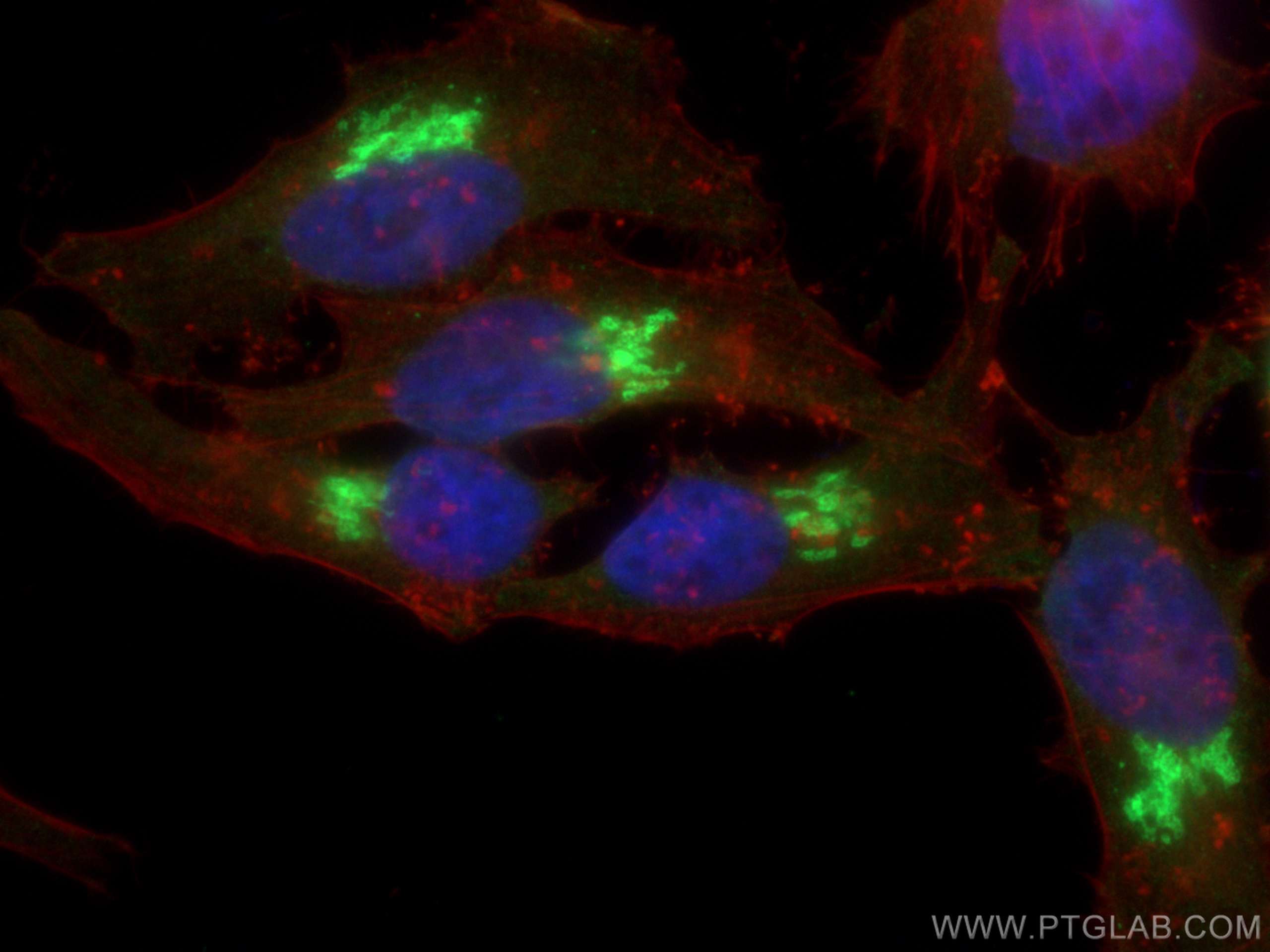 IF Staining of HeLa using 15126-1-AP