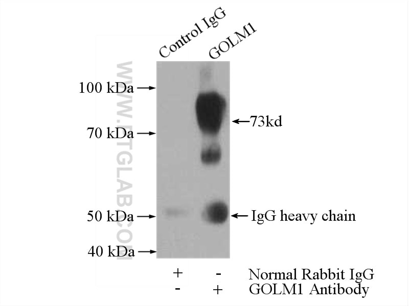 Immunoprecipitation (IP) experiment of HeLa cells using GP73/GOLPH2 Polyclonal antibody (15126-1-AP)