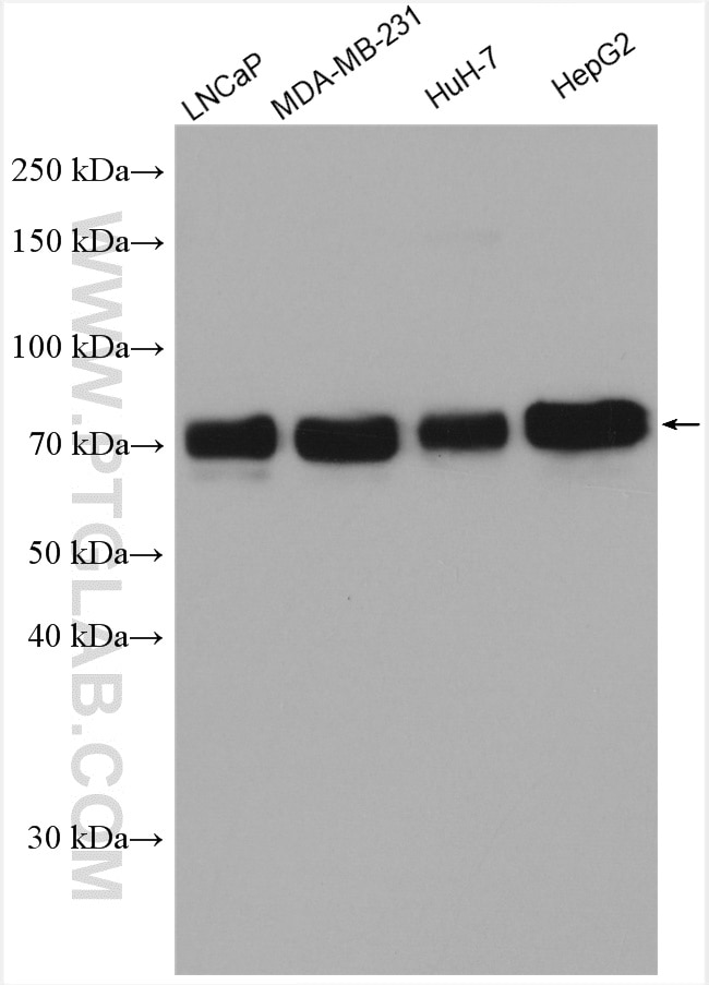 WB analysis using 15126-1-AP