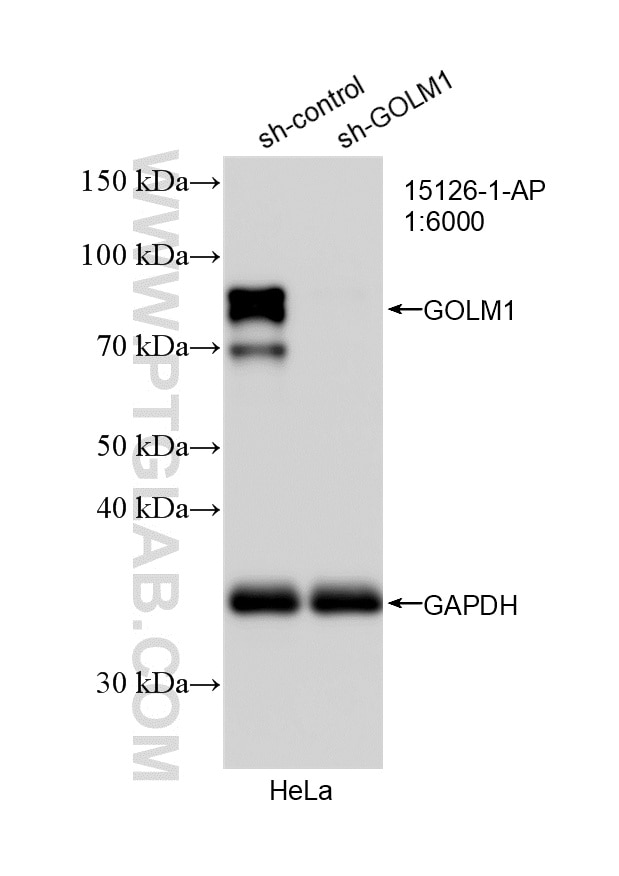 WB analysis of HeLa using 15126-1-AP Western Blot (WB) analysis of HeLa cells using GP73/GOLPH2 Polyclonal antibody (15126-1-AP)