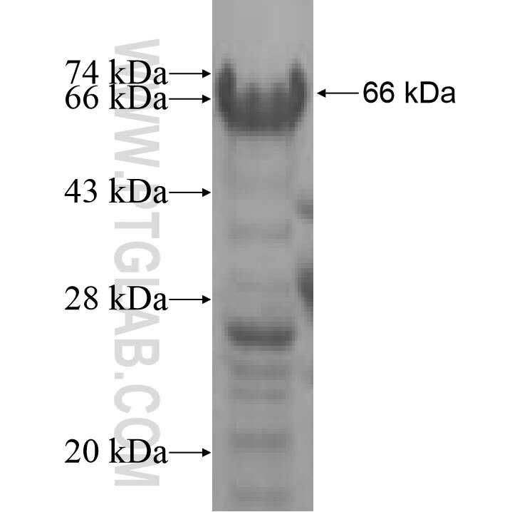 GOLM1 fusion protein Ag7474 SDS-PAGE