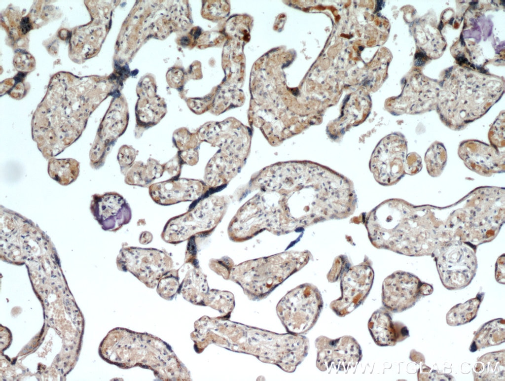 Immunohistochemistry (IHC) staining of human placenta tissue using GOLPH3 Polyclonal antibody (19112-1-AP)