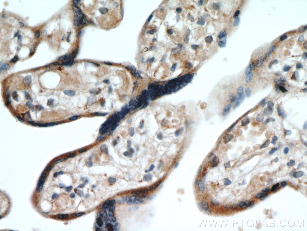 Immunohistochemistry (IHC) staining of human placenta tissue using GOLPH3 Polyclonal antibody (19112-1-AP)