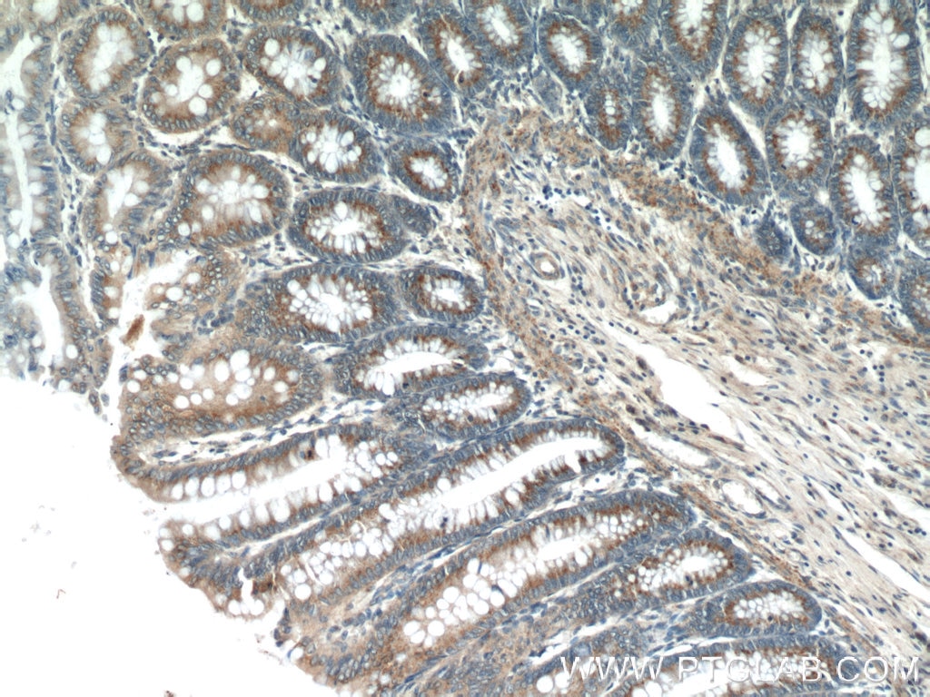 Immunohistochemistry (IHC) staining of human colon tissue using GOLPH3 Polyclonal antibody (19112-1-AP)