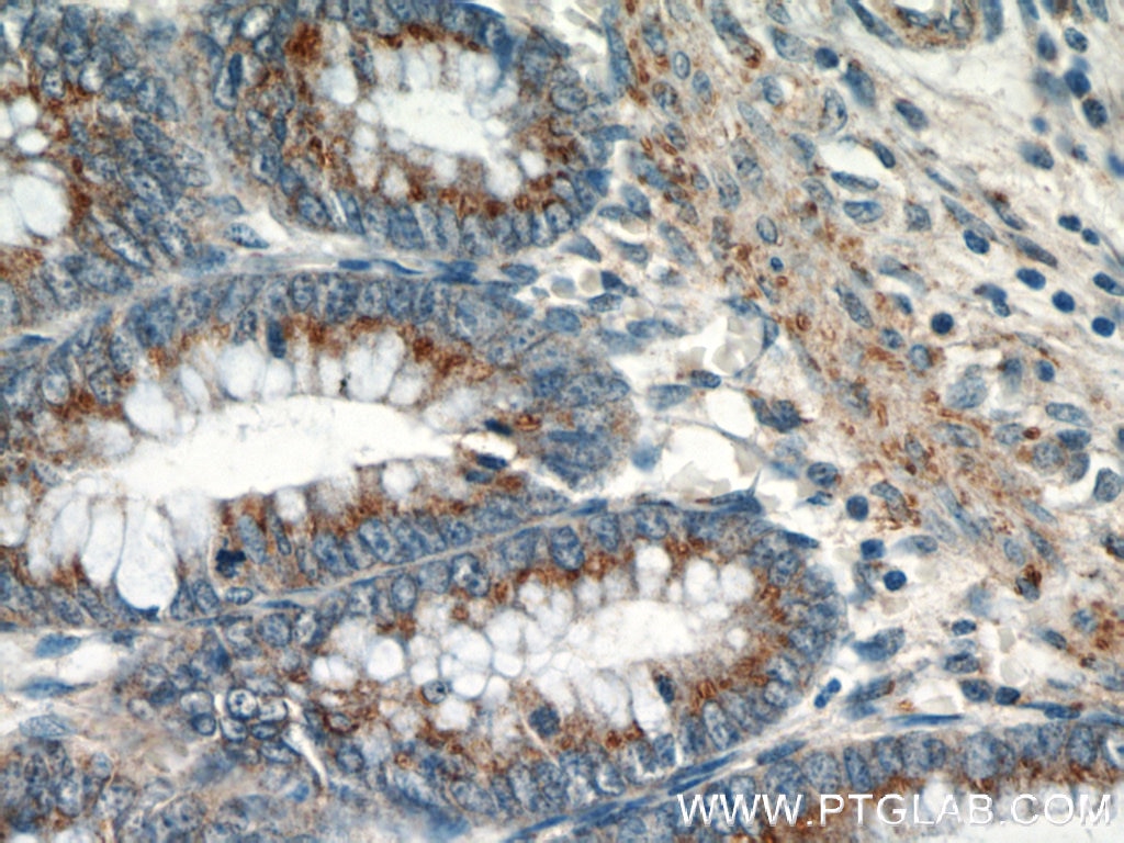 IHC staining of human colon using 19112-1-AP