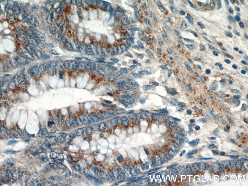 Immunohistochemistry (IHC) staining of human colon tissue using GOLPH3 Polyclonal antibody (19112-1-AP)