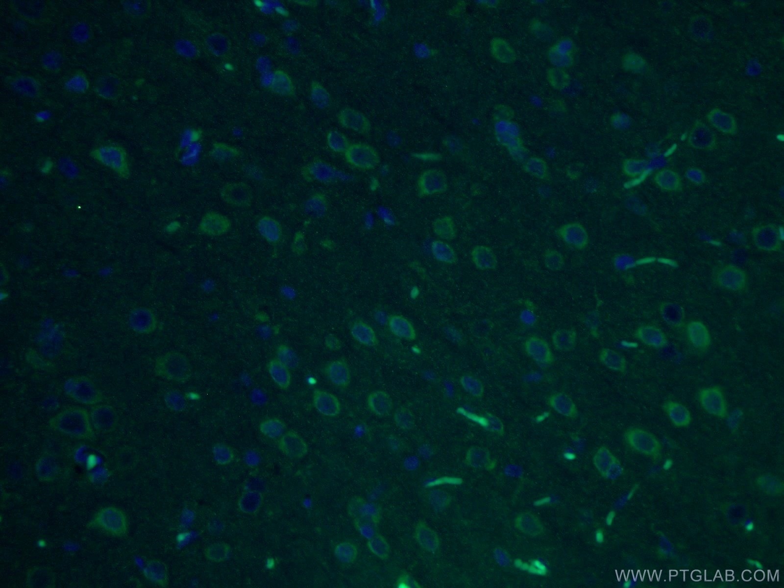 Immunofluorescence (IF) / fluorescent staining of rat brain tissue using Syntabulin Polyclonal antibody (16972-1-AP)