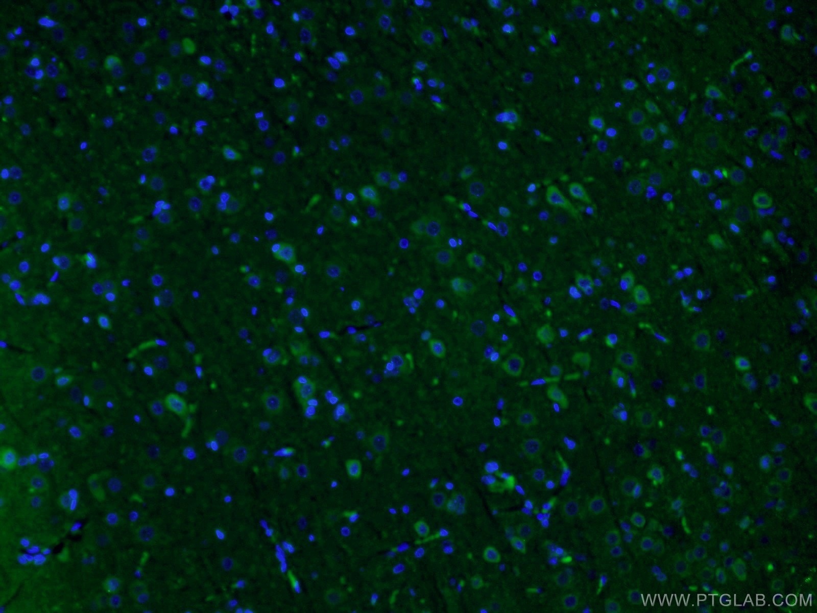 Immunofluorescence (IF) / fluorescent staining of rat brain tissue using Syntabulin Polyclonal antibody (16972-1-AP)