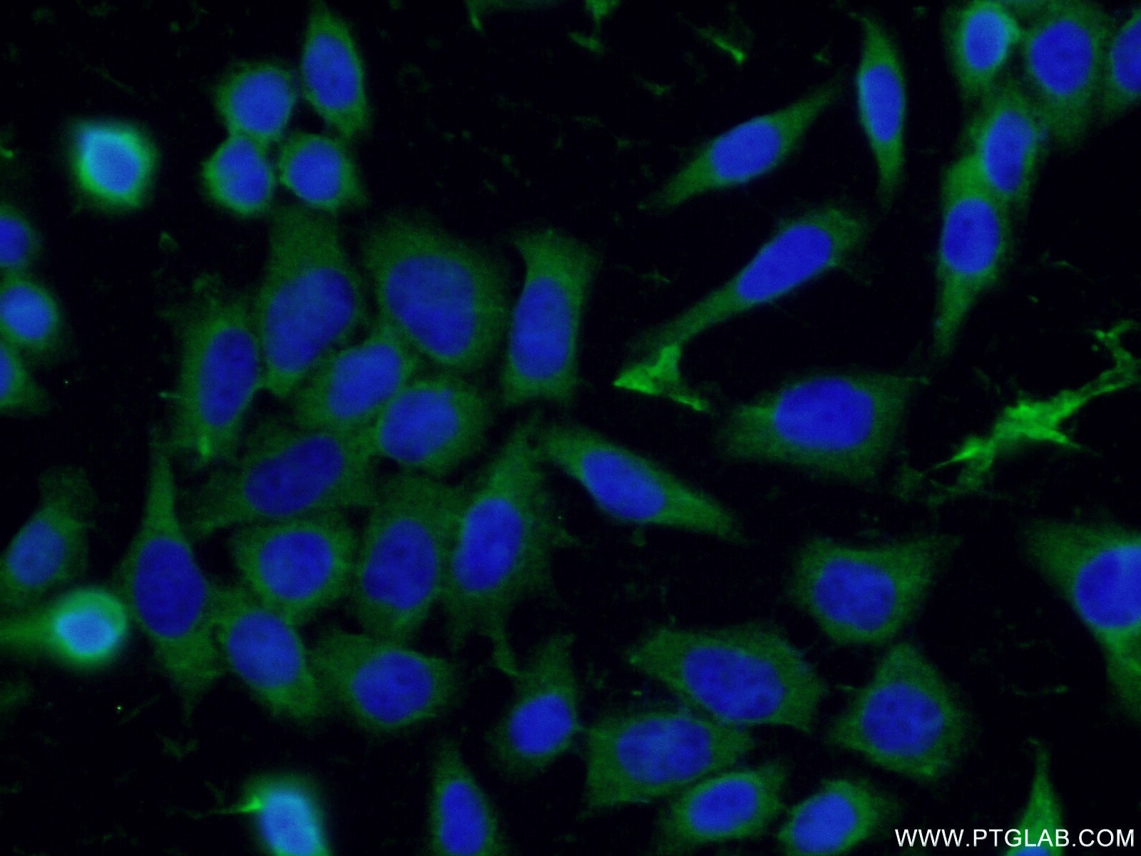 Immunofluorescence (IF) / fluorescent staining of HeLa cells using Syntabulin Polyclonal antibody (16972-1-AP)