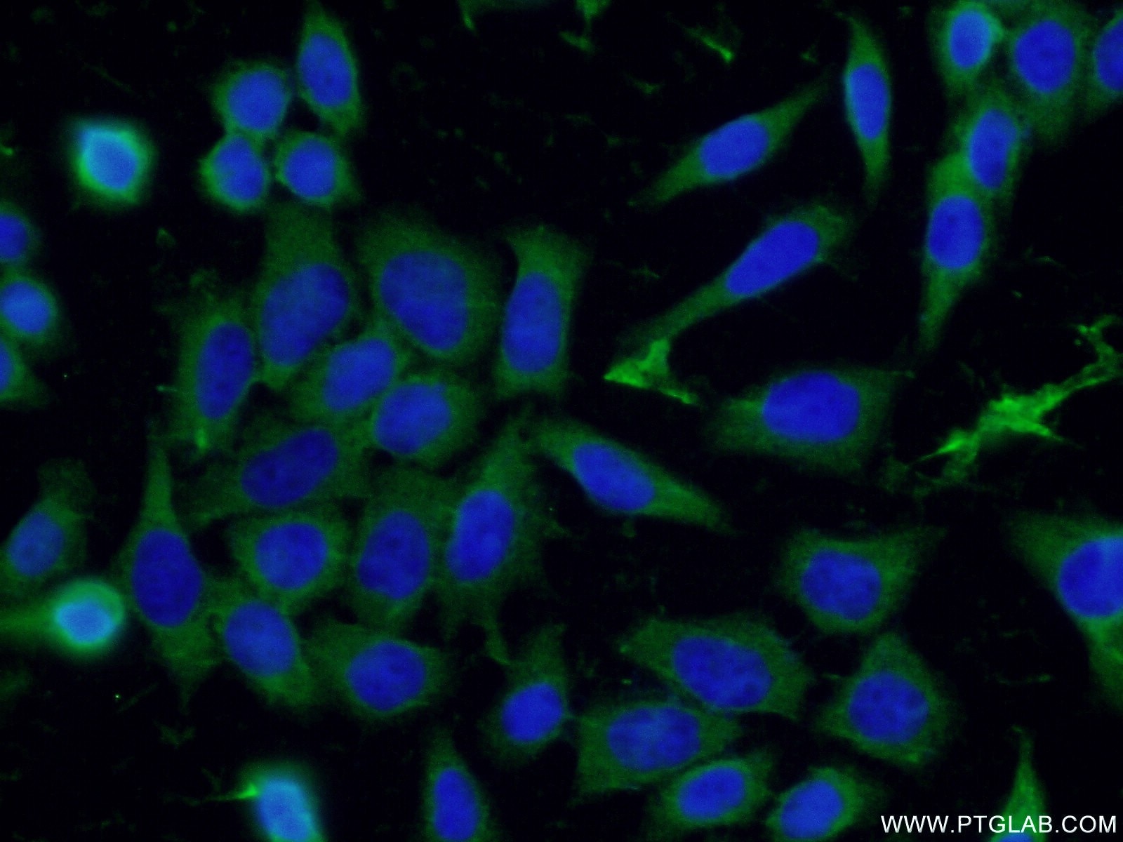 IF Staining of HeLa using 16972-1-AP