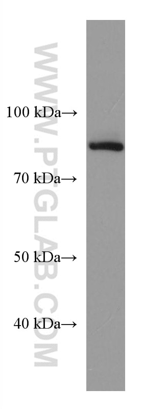 Western Blot (WB) analysis of HeLa cells using GOLSYN Monoclonal antibody (67595-1-Ig)