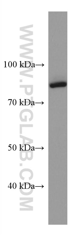 Western Blot (WB) analysis of HepG2 cells using GOLSYN Monoclonal antibody (67595-1-Ig)
