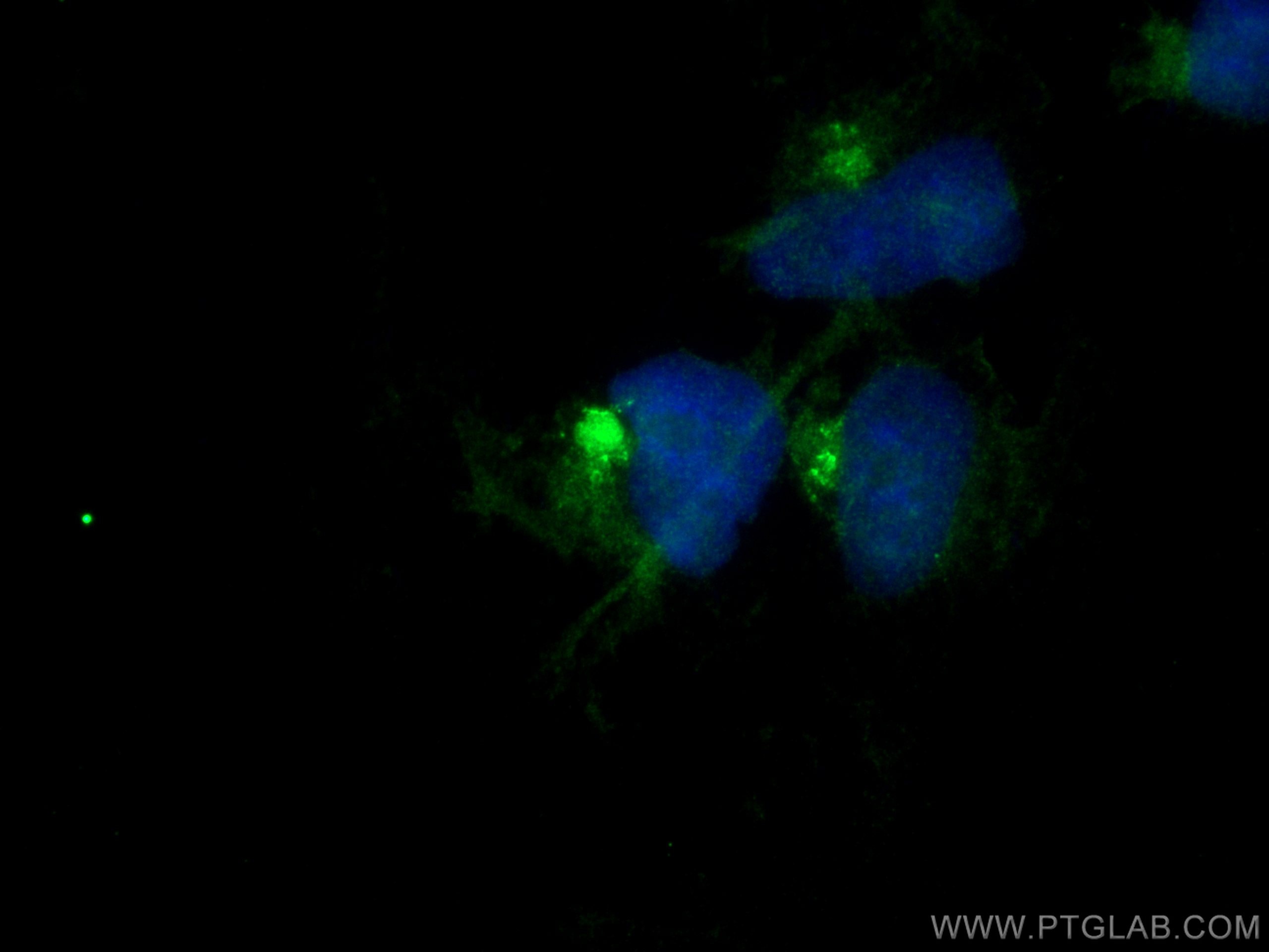 Immunofluorescence (IF) / fluorescent staining of HEK-293 cells using GOPC Polyclonal antibody (12163-1-AP)