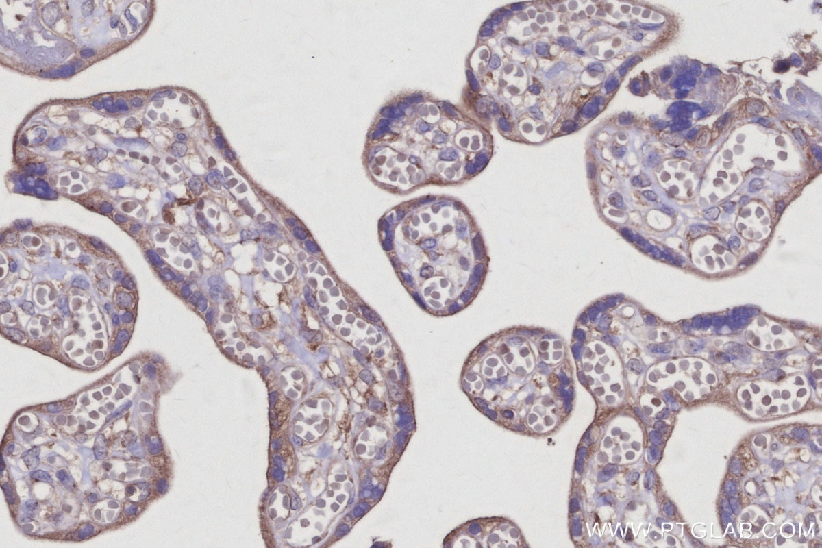 IHC staining of human placenta using 12163-1-AP Immunohistochemistry (IHC) staining of human placenta tissue using GOPC Polyclonal antibody (12163-1-AP)