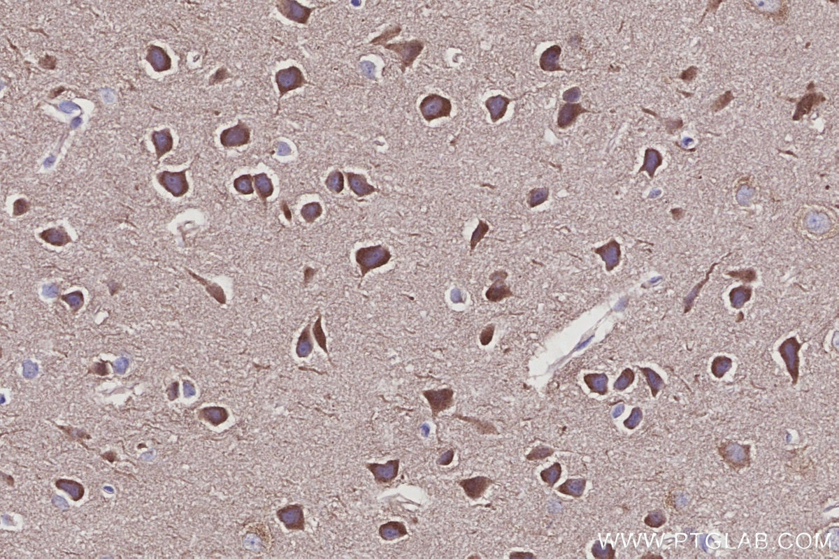 IHC staining of mouse brain using 12163-1-AP Immunohistochemistry (IHC) staining of mouse brain tissue using GOPC Polyclonal antibody (12163-1-AP)