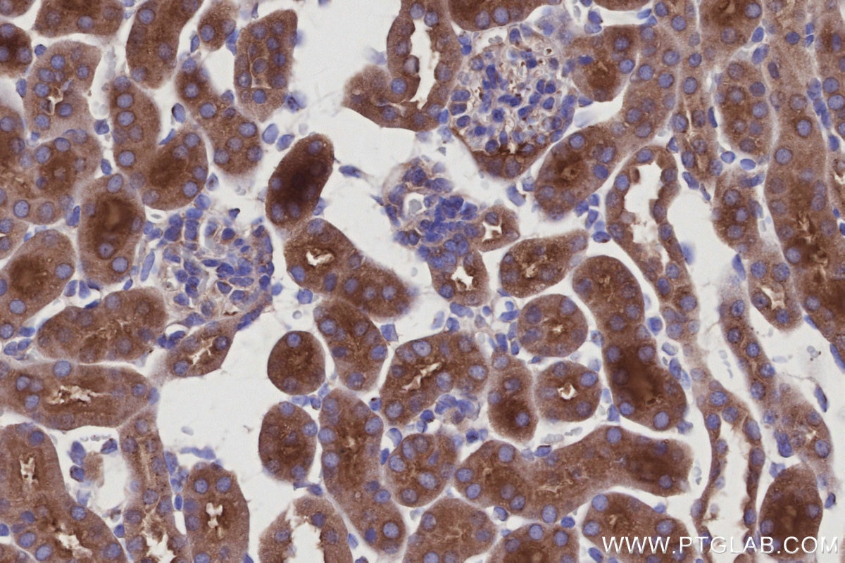 Immunohistochemistry (IHC) staining of mouse kidney tissue using GOPC Polyclonal antibody (12163-1-AP)