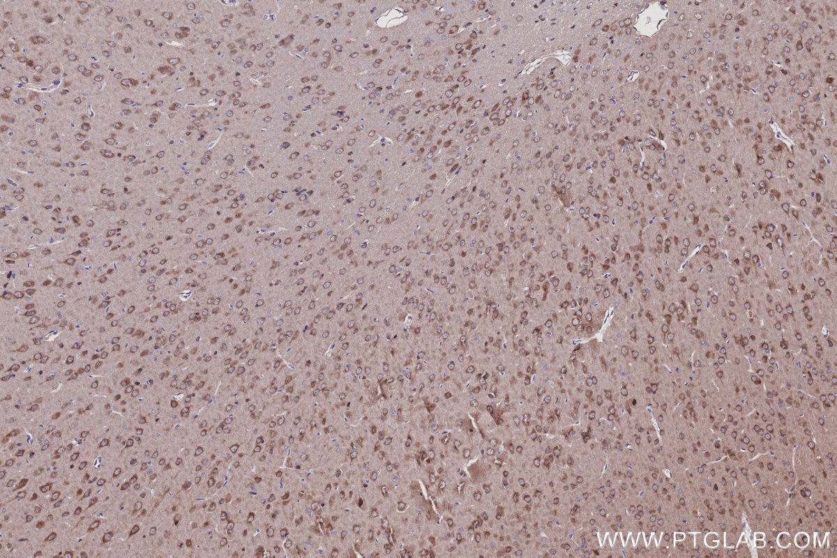 IHC staining of rat brain using 12163-1-AP Immunohistochemistry (IHC) staining of rat brain tissue using GOPC Polyclonal antibody (12163-1-AP)