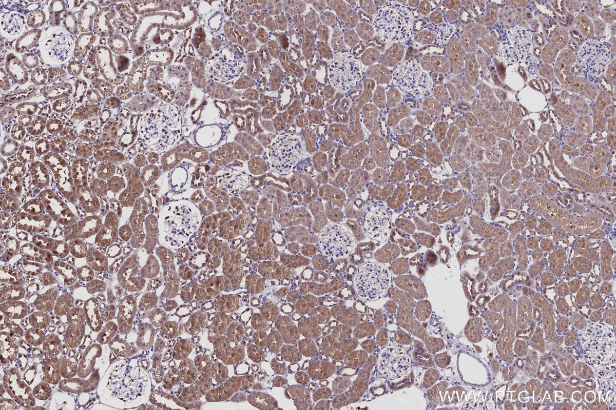 Immunohistochemistry (IHC) staining of rat kidney tissue using GOPC Polyclonal antibody (12163-1-AP)