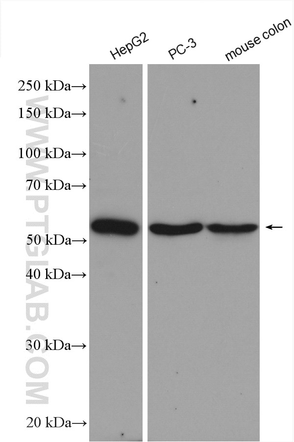 Western Blot (WB) analysis of various lysates using GOPC Polyclonal antibody (12163-1-AP)