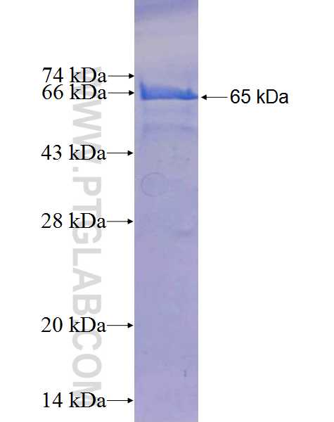 GOPC fusion protein Ag2804 SDS-PAGE