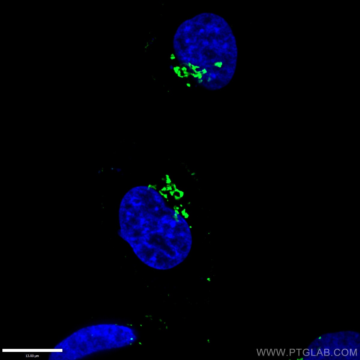 IF Staining of HepG2 using 10598-1-AP