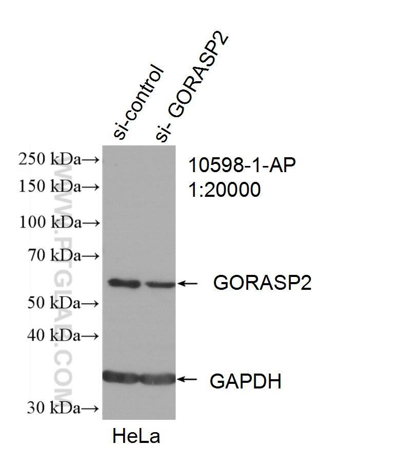 WB analysis of HeLa using 10598-1-AP