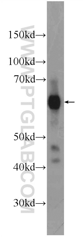 Western Blot (WB) analysis of rat testis tissue using GORASP2 Polyclonal antibody (10598-1-AP)