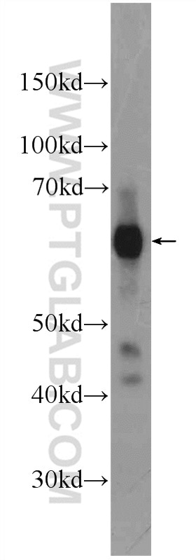 WB analysis of rat testis using 10598-1-AP