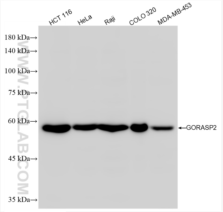 Western Blot (WB) analysis of various lysates using GORASP2 Recombinant antibody (85077-5-RR)
