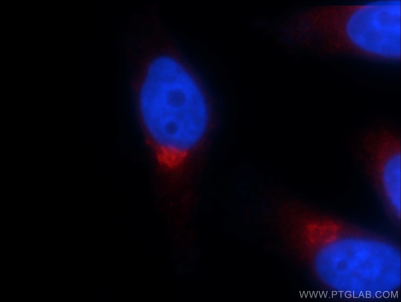 Immunofluorescence (IF) / fluorescent staining of HepG2 cells using GOSR2/Membrin Polyclonal antibody (12095-1-AP)