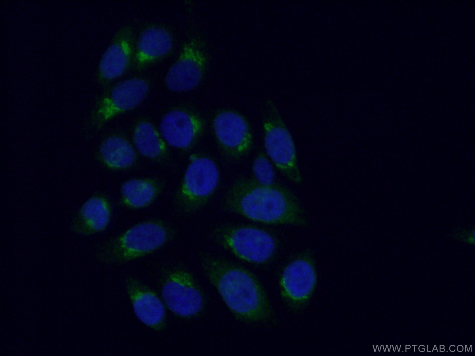 Immunofluorescence (IF) / fluorescent staining of HepG2 cells using GOSR2/Membrin Polyclonal antibody (12095-1-AP)