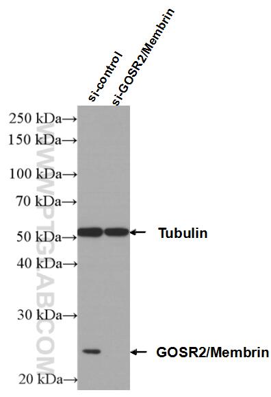 Western Blot (WB) analysis of Jurkat cells using GOSR2/Membrin Polyclonal antibody (12095-1-AP)
