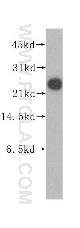 Western Blot (WB) analysis of human liver tissue using GOSR2/Membrin Polyclonal antibody (12095-1-AP)