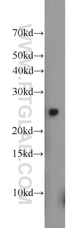 Western Blot (WB) analysis of mouse liver tissue using GOSR2/Membrin Polyclonal antibody (12095-1-AP)